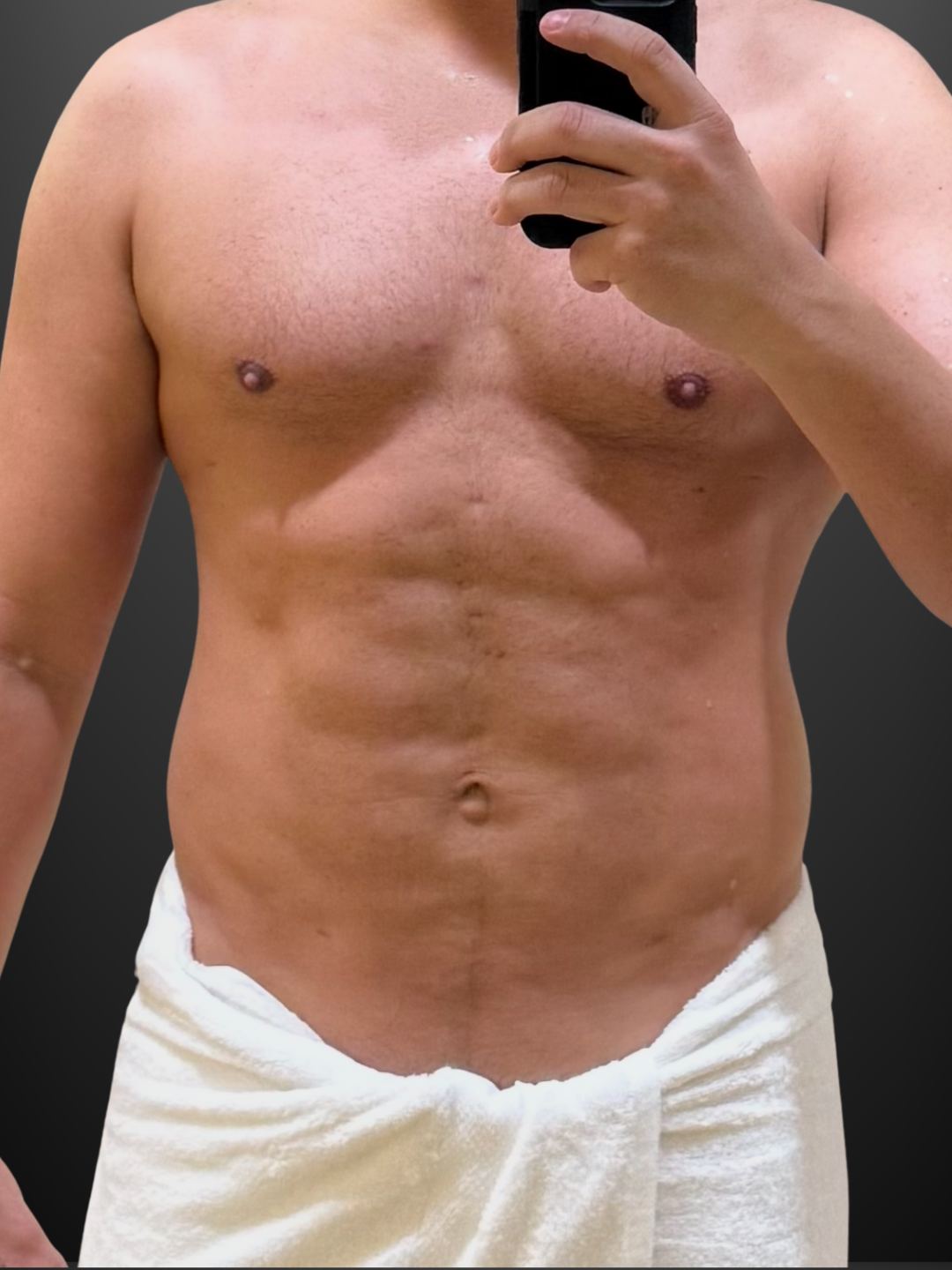 Male HD VASER lipo with pectoral enhancement — pre-operative reference image.